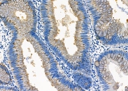 Invitrogen ETFDH Polyclonal Antibody 100 &mu;L; Unconjugated:Antibodies,