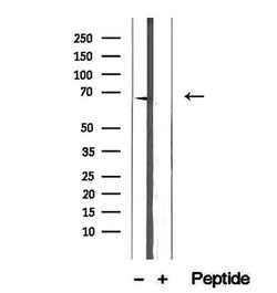 Invitrogen ETFDH Polyclonal Antibody 100 &mu;L; Unconjugated:Antibodies,