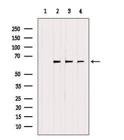 Invitrogen ETFDH Polyclonal Antibody 100 &mu;L; Unconjugated:Antibodies,