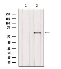 Invitrogen ETV5 Polyclonal Antibody 100 &mu;L | Buy Online | Invitrogen&trade; | Fisher Scientific
