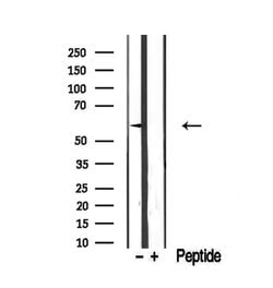 Invitrogen ETV5 Polyclonal Antibody 100 &mu;L | Buy Online | Invitrogen&trade; | Fisher Scientific