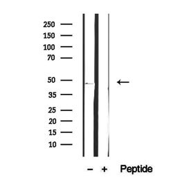 Invitrogen FBXO22 Polyclonal Antibody 100 &mu;L; Unconjugated:Antibodies,