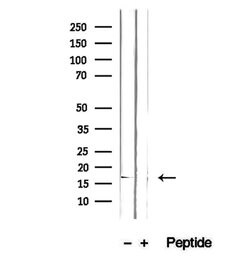 GMFG Polyclonal Antibody, Invitrogen 100 &mu;L; Unconjugated:Antibodies,