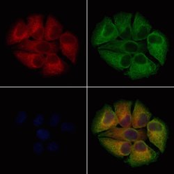 Invitrogen GPD2 Polyclonal Antibody 100 &mu;L; Unconjugated:Antibodies,