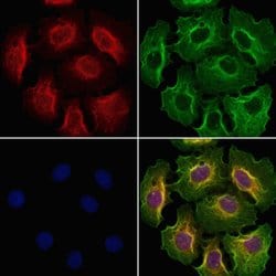 Invitrogen GSTM4 Polyclonal Antibody 100 &mu;L; Unconjugated:Antibodies,