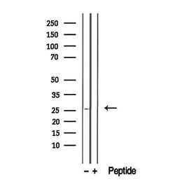 Invitrogen GSTM4 Polyclonal Antibody 100 &mu;L; Unconjugated:Antibodies,
