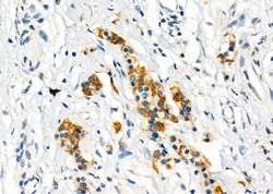 Invitrogen ITLN1 Polyclonal Antibody 100 &mu;L | Buy Online | Invitrogen&trade; | Fisher Scientific