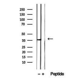 Invitrogen ITLN1 Polyclonal Antibody 100 &mu;L | Buy Online | Invitrogen&trade; | Fisher Scientific