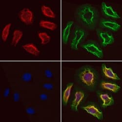 Invitrogen LAPTM4B Polyclonal Antibody 100 &mu;L | Buy Online | Invitrogen&trade; | Fisher Scientific