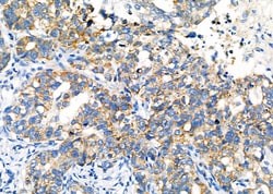 Invitrogen LAPTM4B Polyclonal Antibody 100 &mu;L | Buy Online | Invitrogen&trade; | Fisher Scientific