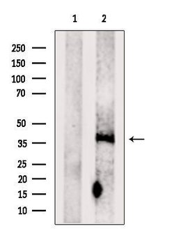 Invitrogen LAPTM4B Polyclonal Antibody 100 &mu;L | Buy Online | Invitrogen&trade; | Fisher Scientific