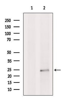 Invitrogen LAPTM4B Polyclonal Antibody 100 &mu;L | Buy Online | Invitrogen&trade; | Fisher Scientific