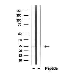 Invitrogen LAPTM4B Polyclonal Antibody 100 &mu;L | Buy Online | Invitrogen&trade; | Fisher Scientific