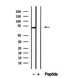 Invitrogen eIF2d Polyclonal Antibody 100 &mu;L | Buy Online | Invitrogen&trade; | Fisher Scientific