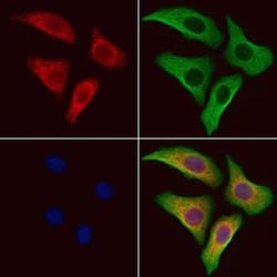 Invitrogen SLC39A6 Polyclonal Antibody 100 &mu;L; Unconjugated:Antibodies,