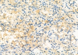 Invitrogen SLC39A6 Polyclonal Antibody 100 &mu;L; Unconjugated:Antibodies,