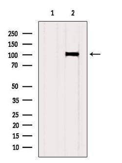 Invitrogen SLC39A6 Polyclonal Antibody 100 &mu;L; Unconjugated:Antibodies,