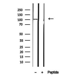 Invitrogen MTHFD1L Polyclonal Antibody 100 &mu;L; Unconjugated:Antibodies,
