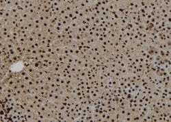 Invitrogen NAT10 Polyclonal Antibody 100 &mu;L; Unconjugated:Antibodies,
