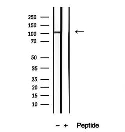 Invitrogen NAT10 Polyclonal Antibody 100 &mu;L; Unconjugated:Antibodies,