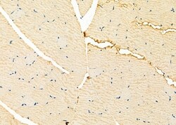 Invitrogen NCKAP1 Polyclonal Antibody 100 &mu;L; Unconjugated:Antibodies,
