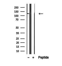 Invitrogen NCKAP1 Polyclonal Antibody 100 &mu;L; Unconjugated:Antibodies,