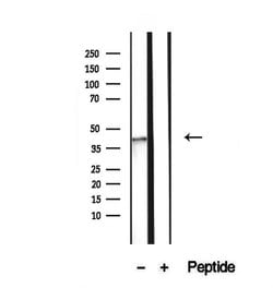 Invitrogen NSDHL Polyclonal Antibody 100 &mu;L | Buy Online | Invitrogen&trade; | Fisher Scientific