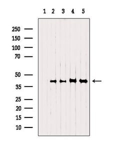 Invitrogen NSDHL Polyclonal Antibody 100 &mu;L | Buy Online | Invitrogen&trade; | Fisher Scientific