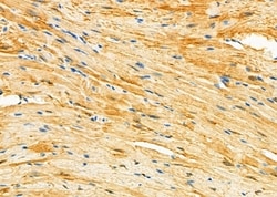 Invitrogen OPHN1 Polyclonal Antibody 100 &mu;L; Unconjugated:Antibodies,