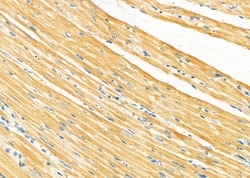 Invitrogen OPHN1 Polyclonal Antibody 100 &mu;L; Unconjugated:Antibodies,