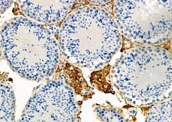 Invitrogen P4HA2 Polyclonal Antibody 100 &mu;L; Unconjugated:Antibodies,