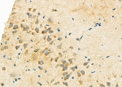 Invitrogen P4HA2 Polyclonal Antibody 100 &mu;L; Unconjugated:Antibodies,