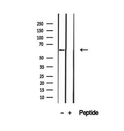 Invitrogen P4HA2 Polyclonal Antibody 100 &mu;L; Unconjugated:Antibodies,