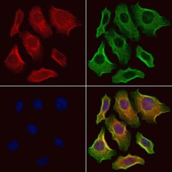 Invitrogen PAFAH2 Polyclonal Antibody 100 &mu;L; Unconjugated:Antibodies,