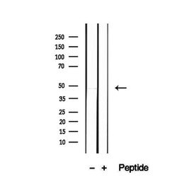 Invitrogen PAFAH2 Polyclonal Antibody 100 &mu;L; Unconjugated:Antibodies,