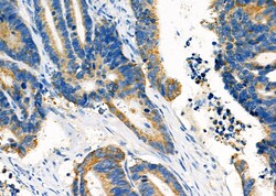 Invitrogen PCCA Polyclonal Antibody 100 &mu;L; Unconjugated:Antibodies,