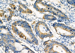 Invitrogen PCCA Polyclonal Antibody 100 &mu;L; Unconjugated:Antibodies,