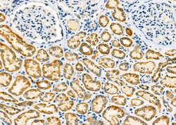 Invitrogen PCCA Polyclonal Antibody 100 &mu;L; Unconjugated:Antibodies,