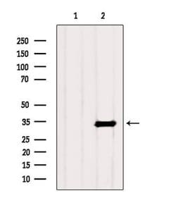 Invitrogen PHF11 Polyclonal Antibody 100 &mu;L; Unconjugated:Antibodies,