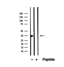 Invitrogen PHF11 Polyclonal Antibody 100 &mu;L; Unconjugated:Antibodies,