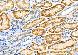 Invitrogen&trade;&nbsp;PIK3IP1 Polyclonal Antibody