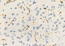 Invitrogen&trade;&nbsp;PIK3IP1 Polyclonal Antibody