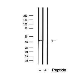 Invitrogen&trade;&nbsp;PIK3IP1 Polyclonal Antibody