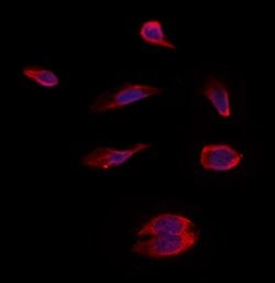 Invitrogen PMM2 Polyclonal Antibody 100 &mu;L | Buy Online | Invitrogen&trade; | Fisher Scientific