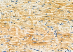 Invitrogen PMM2 Polyclonal Antibody 100 &mu;L | Buy Online | Invitrogen&trade; | Fisher Scientific