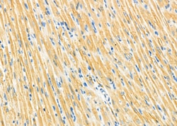 Invitrogen PMM2 Polyclonal Antibody 100 &mu;L | Buy Online | Invitrogen&trade; | Fisher Scientific