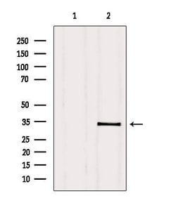 Invitrogen PMM2 Polyclonal Antibody 100 &mu;L | Buy Online | Invitrogen&trade; | Fisher Scientific