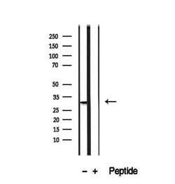 Invitrogen PMM2 Polyclonal Antibody 100 &mu;L | Buy Online | Invitrogen&trade; | Fisher Scientific