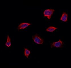 Invitrogen RAB14 Polyclonal Antibody 100 &mu;L; Unconjugated:Antibodies,