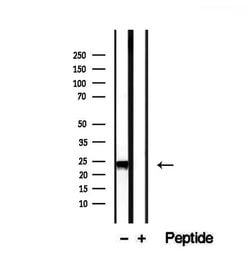 Invitrogen RAB14 Polyclonal Antibody 100 &mu;L; Unconjugated:Antibodies,